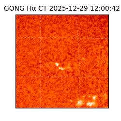 gong - 2025-12-29T12:00:42