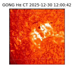 gong - 2025-12-30T12:00:42