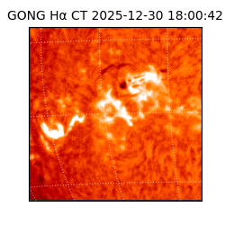 gong - 2025-12-30T18:00:42