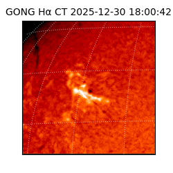 gong - 2025-12-30T18:00:42