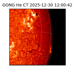 gong - 2025-12-30T12:00:42