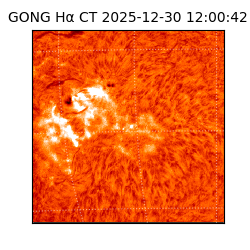 gong - 2025-12-30T12:00:42