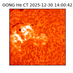 gong - 2025-12-30T14:00:42