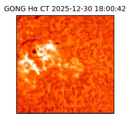 gong - 2025-12-30T18:00:42