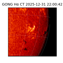 gong - 2025-12-31T22:00:42