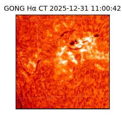gong - 2025-12-31T11:00:42