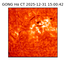 gong - 2025-12-31T15:00:42