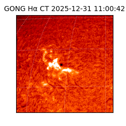 gong - 2025-12-31T11:00:42