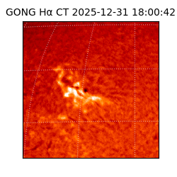 gong - 2025-12-31T18:00:42