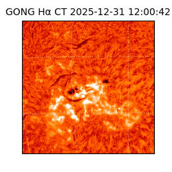 gong - 2025-12-31T12:00:42