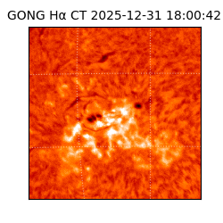 gong - 2025-12-31T18:00:42