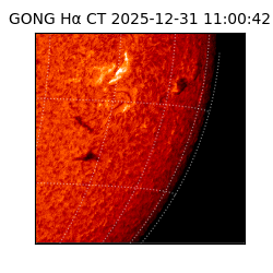 gong - 2025-12-31T11:00:42