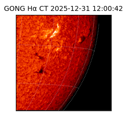 gong - 2025-12-31T12:00:42