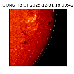 gong - 2025-12-31T18:00:42