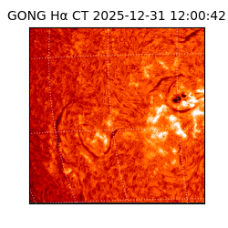 gong - 2025-12-31T12:00:42