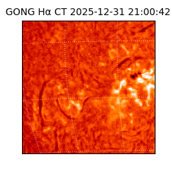 gong - 2025-12-31T21:00:42