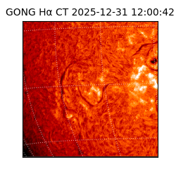gong - 2025-12-31T12:00:42