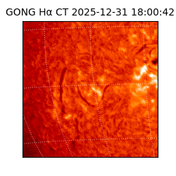 gong - 2025-12-31T18:00:42
