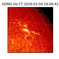 gong - 2026-01-04T16:00:42