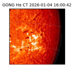 gong - 2026-01-04T16:00:42