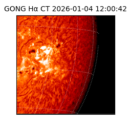 gong - 2026-01-04T12:00:42
