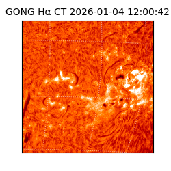 gong - 2026-01-04T12:00:42