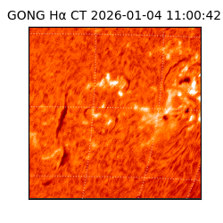 gong - 2026-01-04T11:00:42