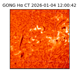 gong - 2026-01-04T12:00:42