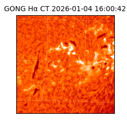 gong - 2026-01-04T16:00:42
