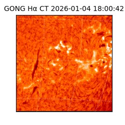 gong - 2026-01-04T18:00:42