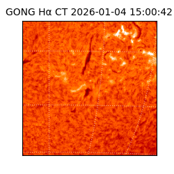 gong - 2026-01-04T15:00:42