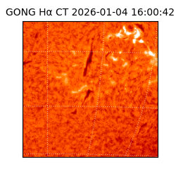 gong - 2026-01-04T16:00:42