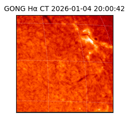 gong - 2026-01-04T20:00:42
