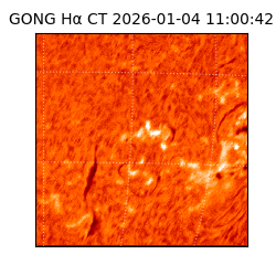 gong - 2026-01-04T11:00:42