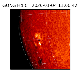 gong - 2026-01-04T11:00:42