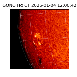 gong - 2026-01-04T12:00:42