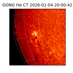 gong - 2026-01-04T20:00:42