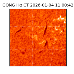 gong - 2026-01-04T11:00:42