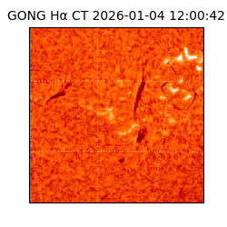 gong - 2026-01-04T12:00:42