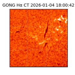 gong - 2026-01-04T18:00:42