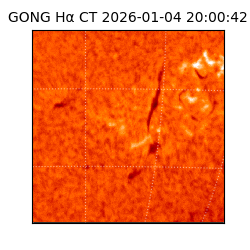 gong - 2026-01-04T20:00:42