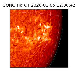 gong - 2026-01-05T12:00:42