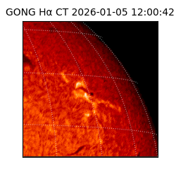 gong - 2026-01-05T12:00:42