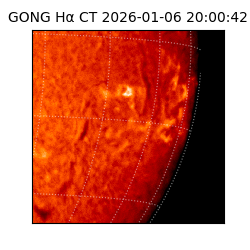 gong - 2026-01-06T20:00:42