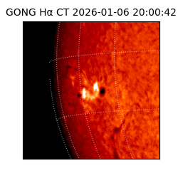 gong - 2026-01-06T20:00:42