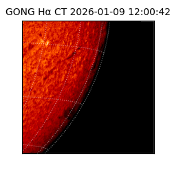 gong - 2026-01-09T12:00:42