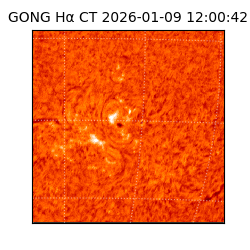 gong - 2026-01-09T12:00:42
