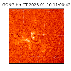 gong - 2026-01-10T11:00:42
