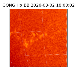 gong - 2026-03-02T18:00:02