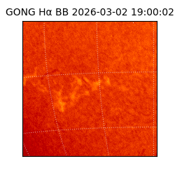 gong - 2026-03-02T19:00:02